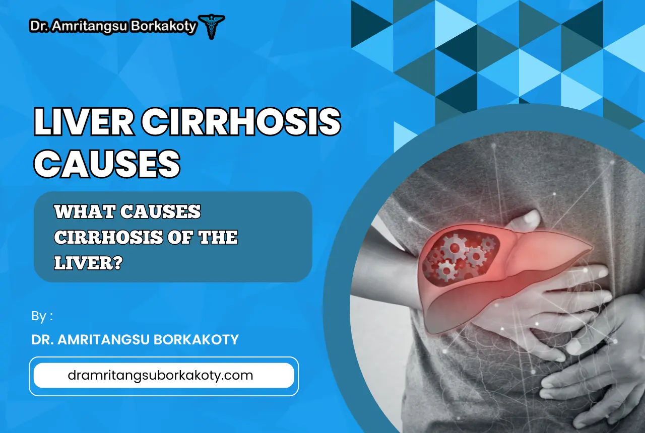 liver cirrhosis causes