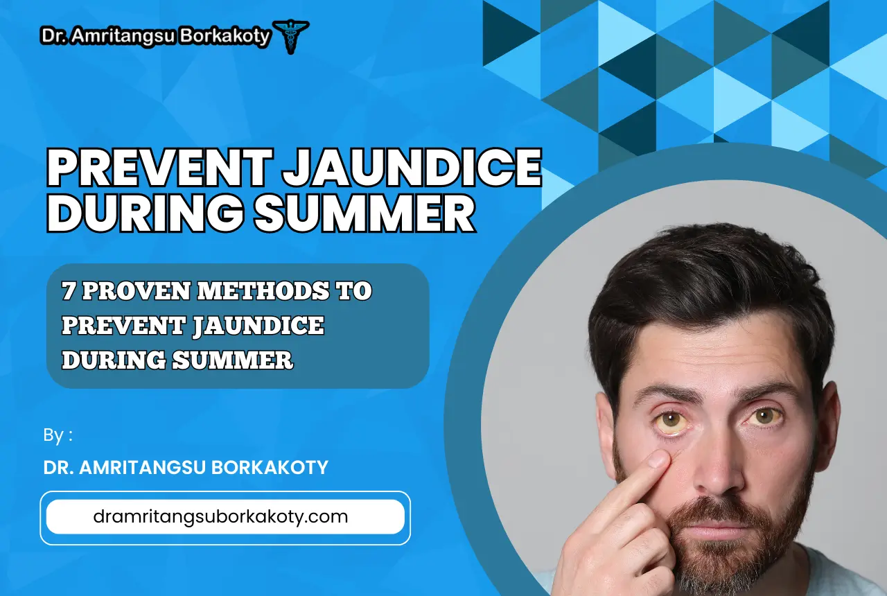 prevent jaundice during summer