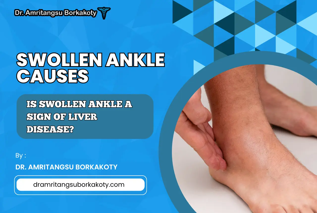 swollen ankle causes