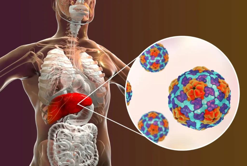 Untreated Viral Hepatitis