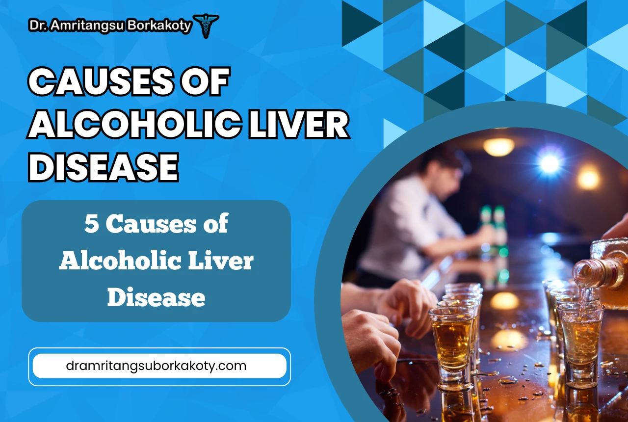 causes of alcoholic liver disease