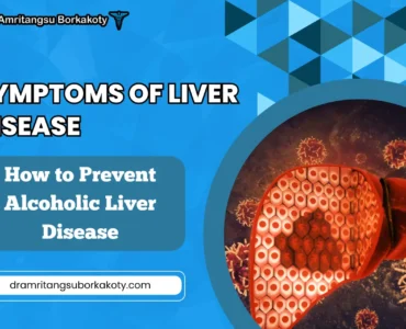 symptoms of liver infection