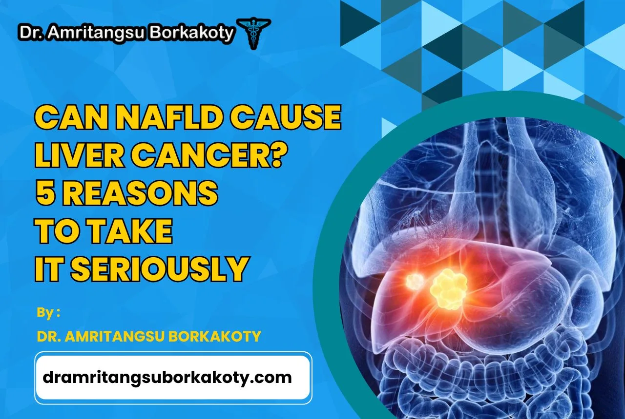 Image: Can NAFLD Cause Liver Cancer